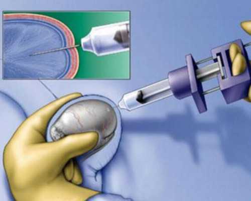 广州供卵试管代怀生子医院排名，附供卵生男孩费用一览！_代怀妈价格表