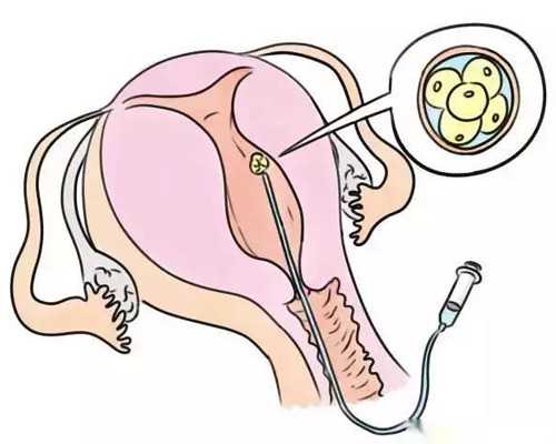 广州供卵试管代怀生子医院排名，附供卵生男孩费用一览！_代怀网包成功