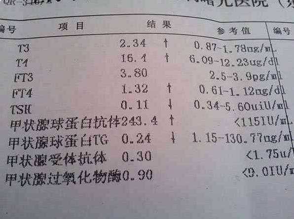 上海助孕真实可靠吗 上海市第一医院试管详细费用 ‘孕囊68*68*32是男是女’